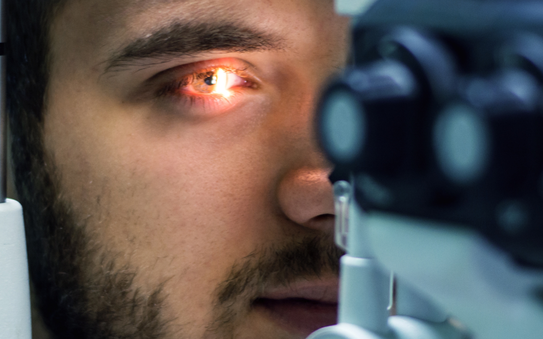 CAPSULOTOMIA YAG LASER