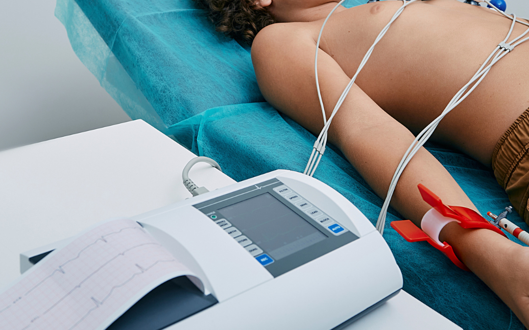 ELETROCARDIOGRAMA (ECG)